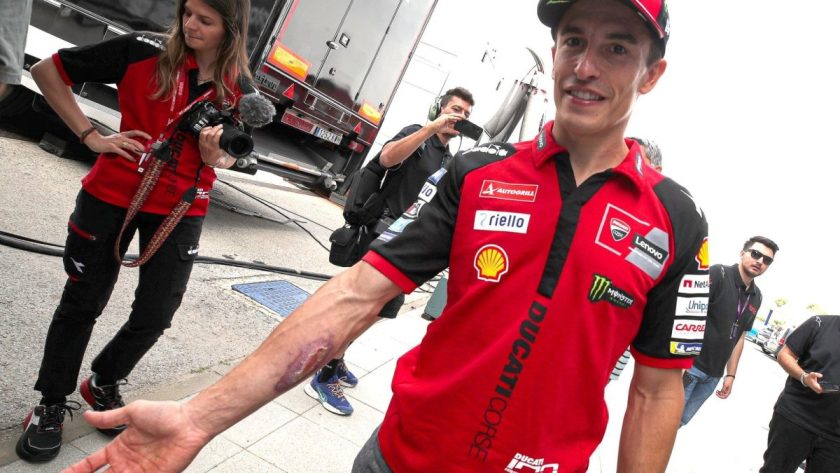 Injury Update: Marc Marquez Reveals COTA Wound as Spanish MotoGP Nears